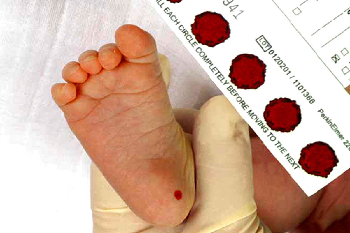 آزمايش خون نوزاد