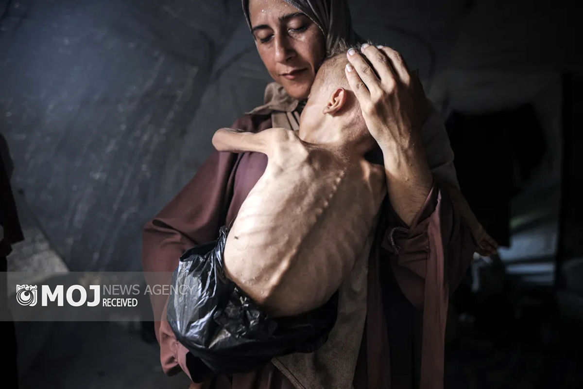 گرسنگی فاجعه بار در غزه