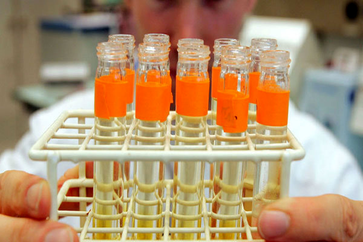 نمونه دوپینگ