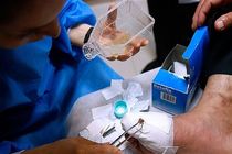 روند درمان بیماری که حین عمل سوخت / برخورد قانونی لازم صورت می‌پذیرد