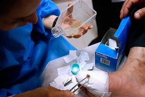 روند درمان بیماری که حین عمل سوخت / برخورد قانونی لازم صورت می‌پذیرد