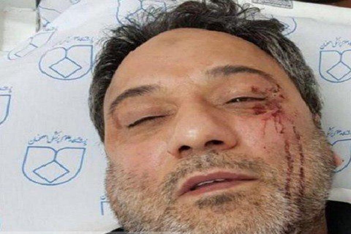پزشک مورد ضرب فارابی