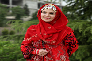 تغییر چهره عجیب ملیکا زارعی / خاله شادونه رو دیگه کسی نمیشناسه