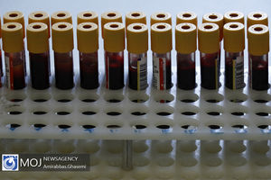 افزایش ۱۸درصدی آمار اهدای خون تهرانی‌ها در سه ماهه نخست سال