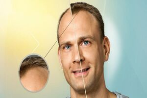 سلول های بنیادی با یکدیگر برای رشد مو همکاری می کنند