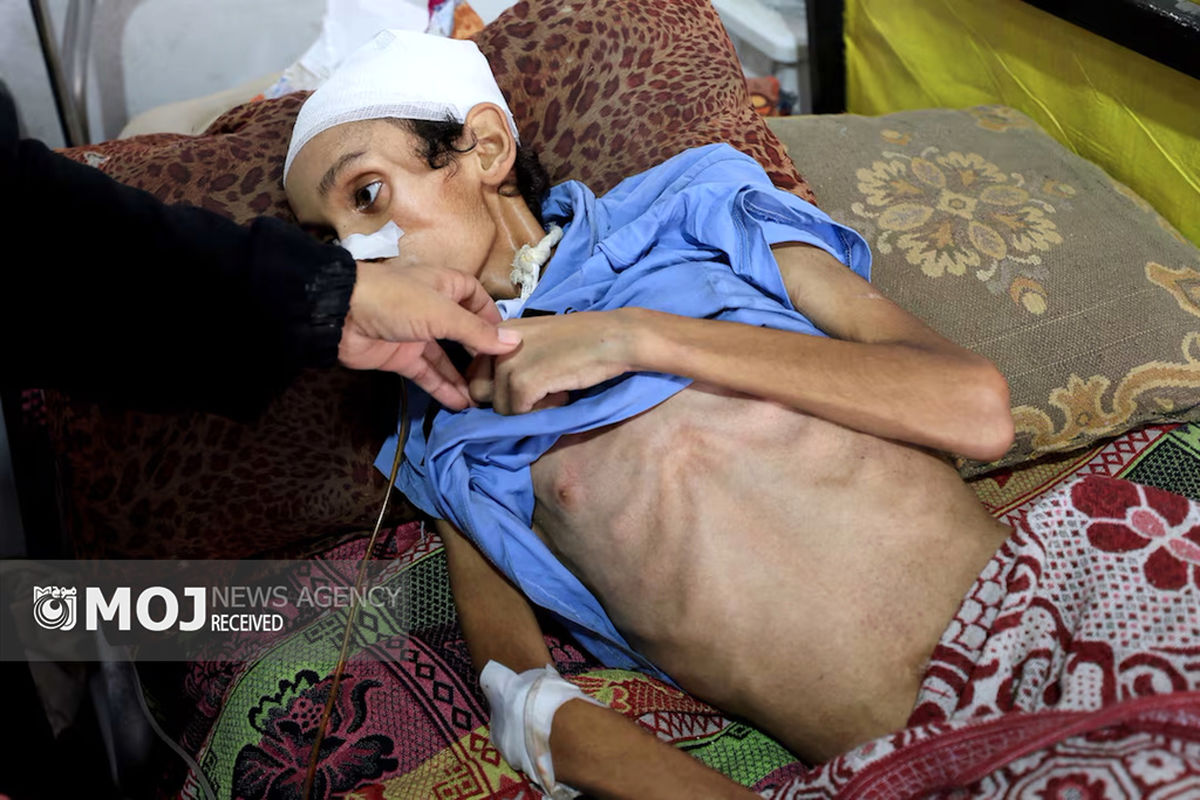 گرسنگی فاجعه بار در غزه