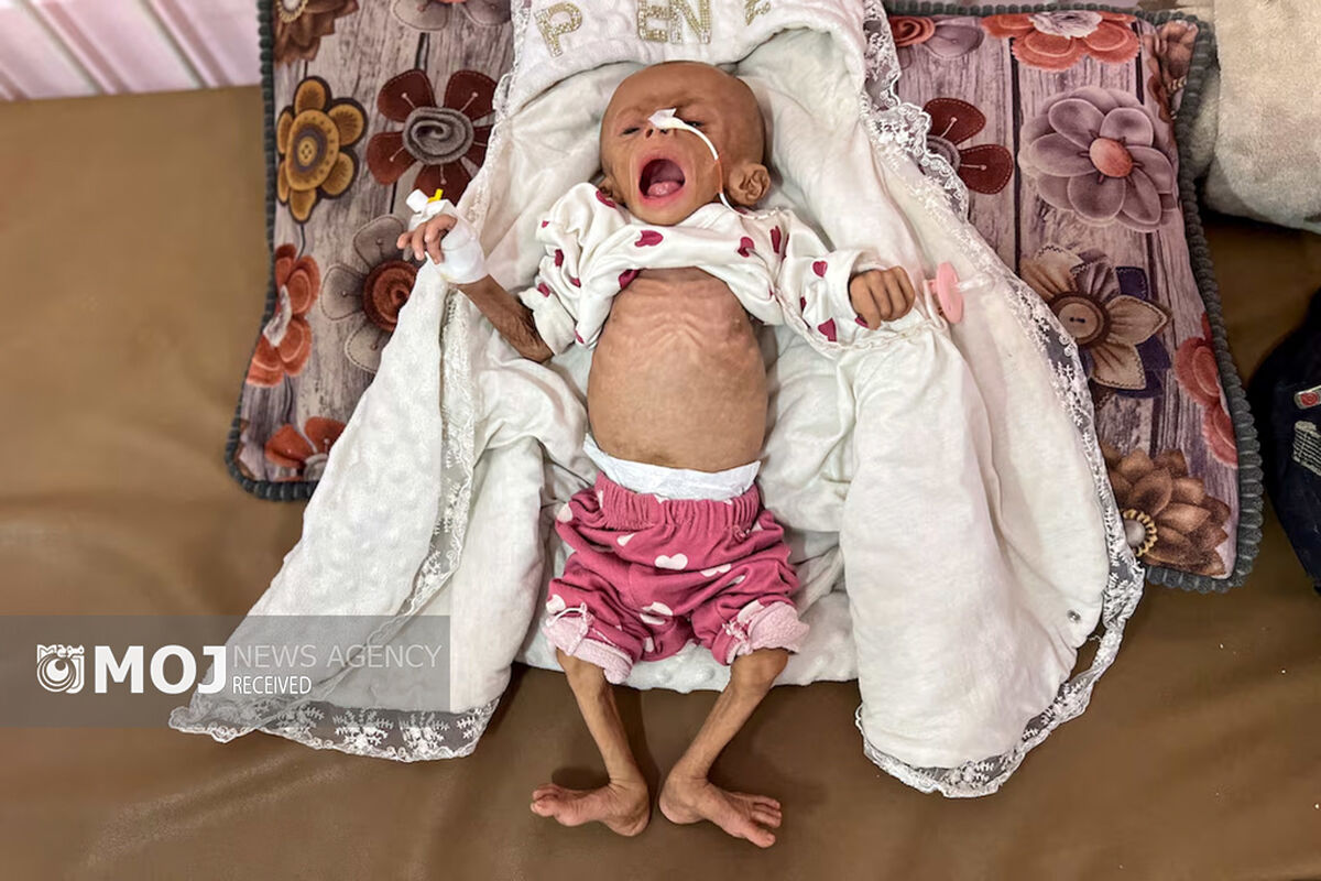 گرسنگی فاجعه بار در غزه
