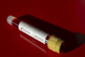 قطر نخستین مورد از ابتلا به ویروس کرونا را تایید کرد