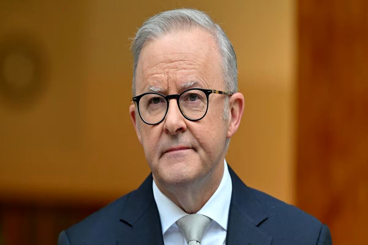 آنتونی آلبانیز