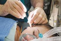دومین جلسه کمیته کشوری کاشت حلزون برگزار شد