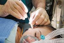 دومین جلسه کمیته کشوری کاشت حلزون برگزار شد