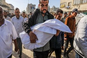 کودک ۴ ساله فلسطینی بر اثر سوء تغذیه جان سپرد