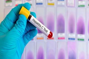 گامی بلند به سوی جامعه‌ای عاری از هپاتیت C/درمان رایگان  برای مبتلایان کلید خورد