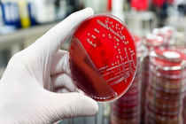 هفدهمین کنگره بین‌المللی انجمن میکروب‌شناسی برگزار می‌شود