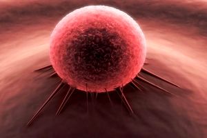 جدیدترین شیوه درمان سرطان چیست