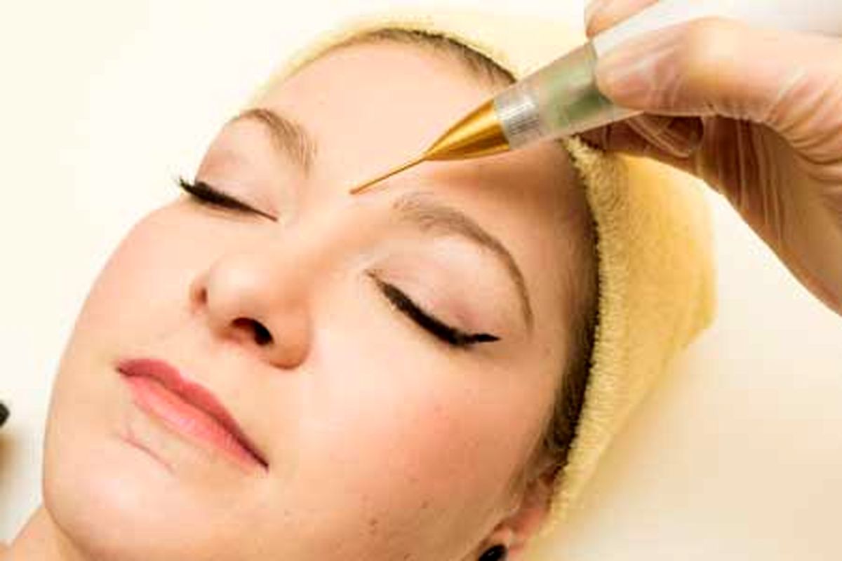 پلاسما درمانی