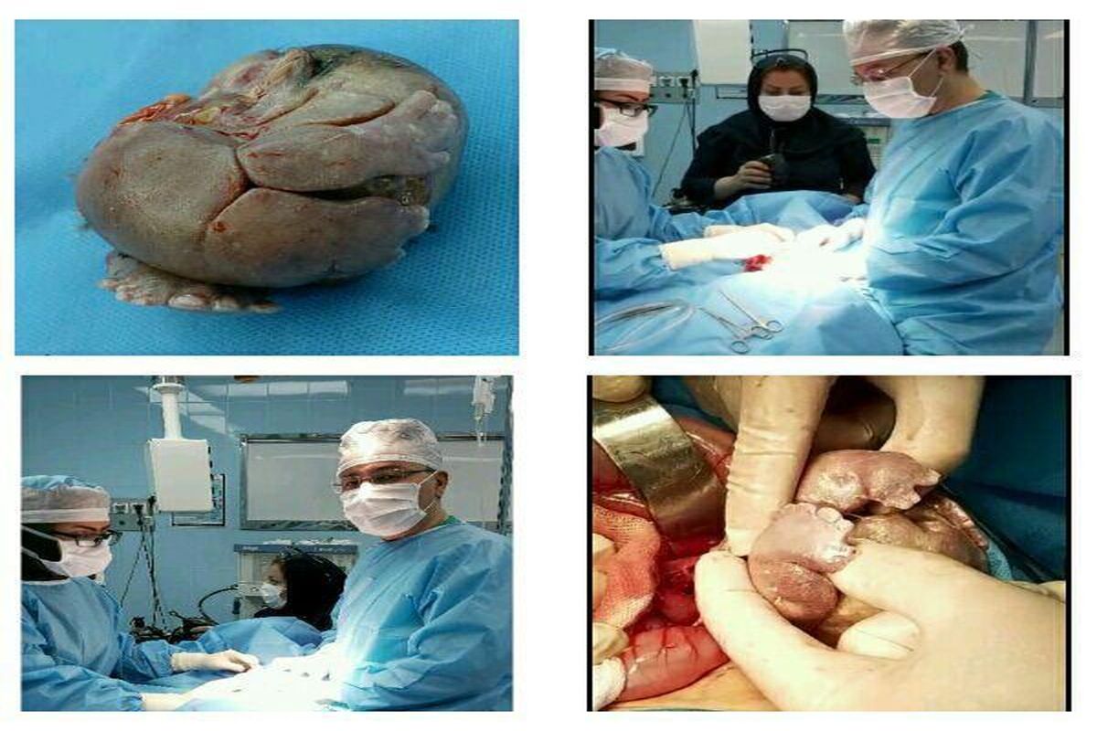 جراحى بسیار نادر بر روی نوزاد