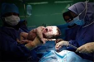 خطر افزایش سزارین‌های مناسبتی در سال جاری