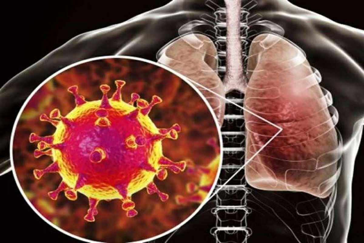 ویروس کرونا