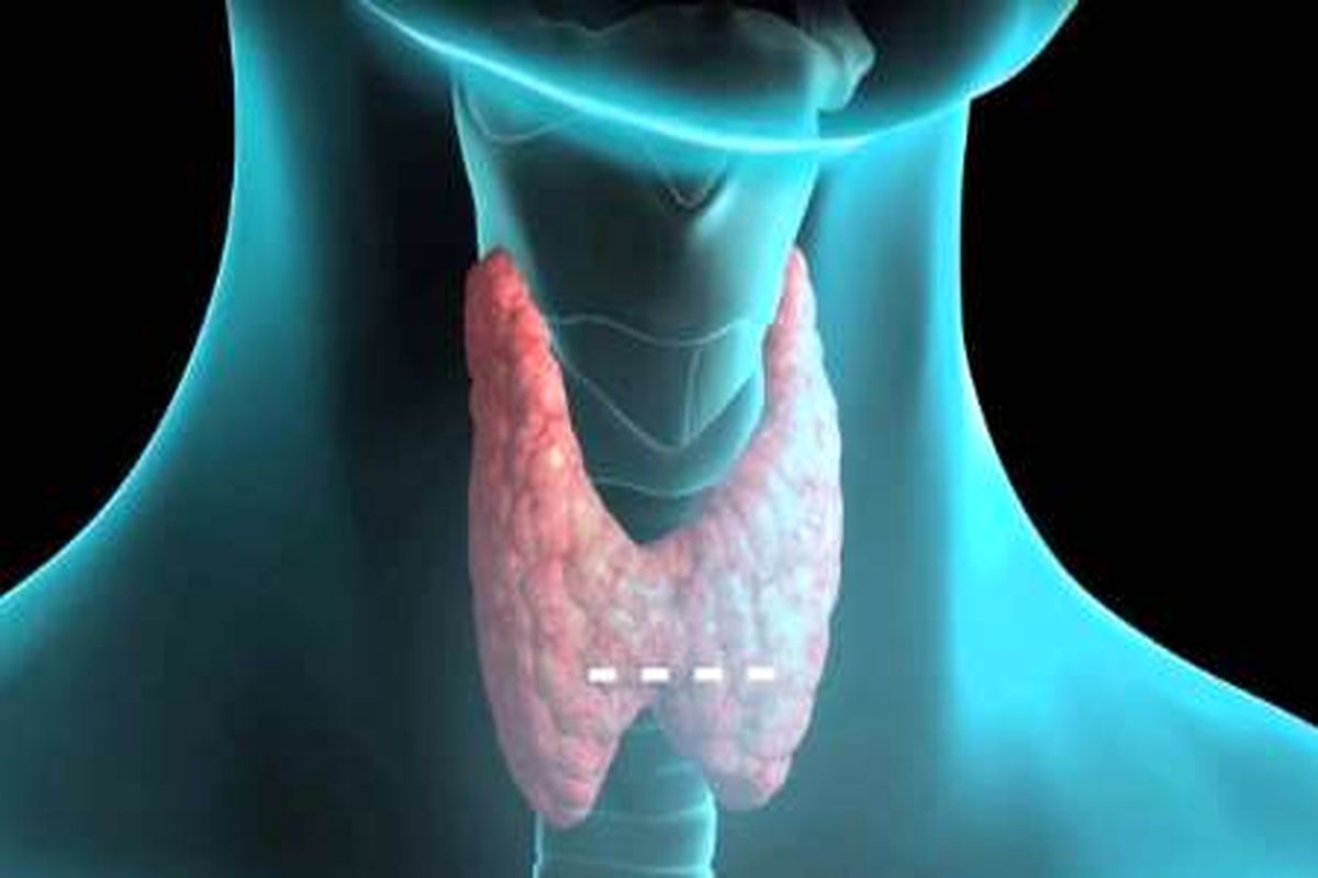 اختلال تیروئید 