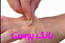 خراسان رضوی دارای تنها بانک اختصاصی و فعال پوست کشور