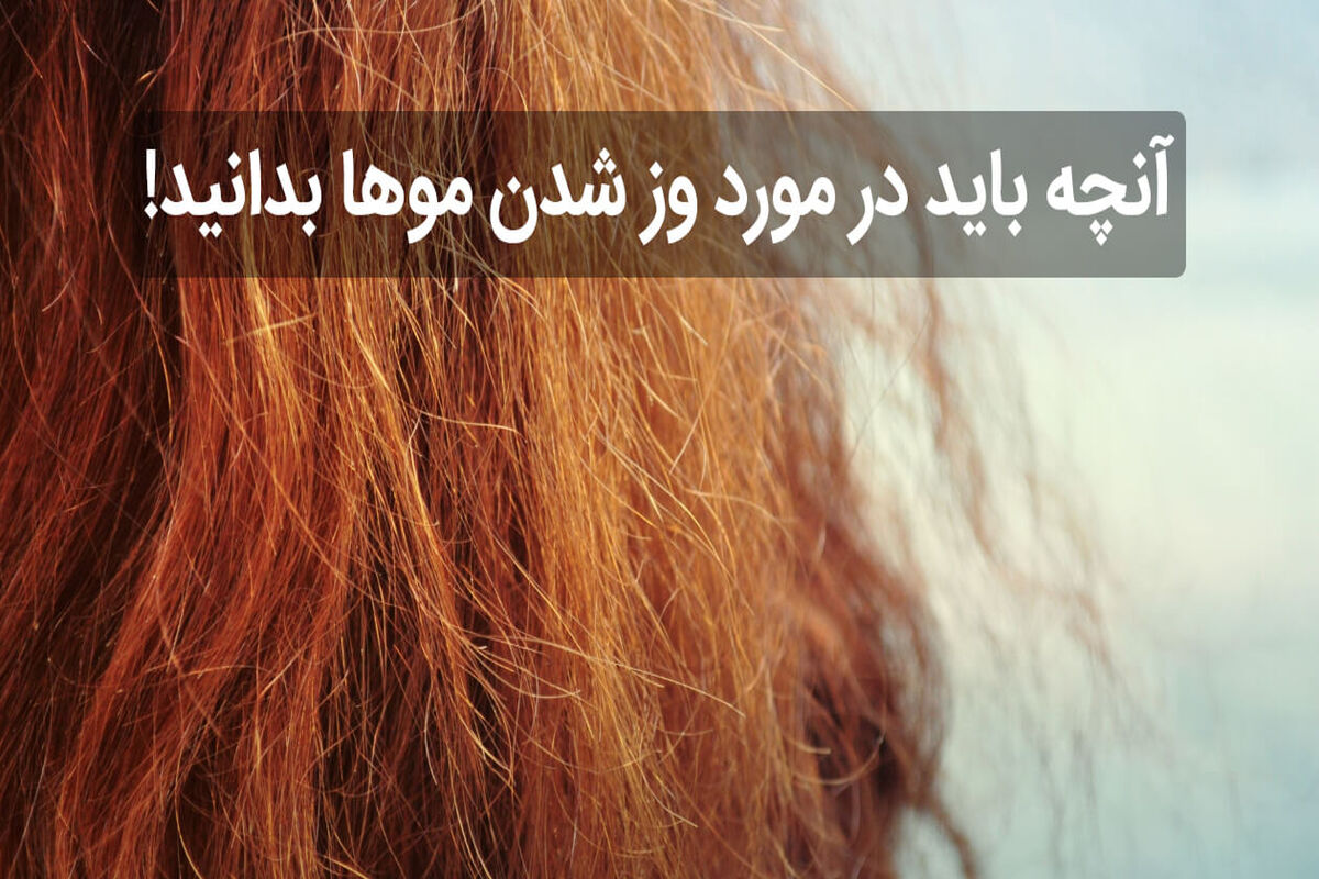 وز شدن