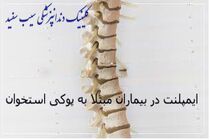 ایمپلنت دندان و پوکی استخوان