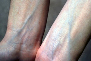 چرا رگ‌های بدن آبی یا سبز دیده می‌شوند؟