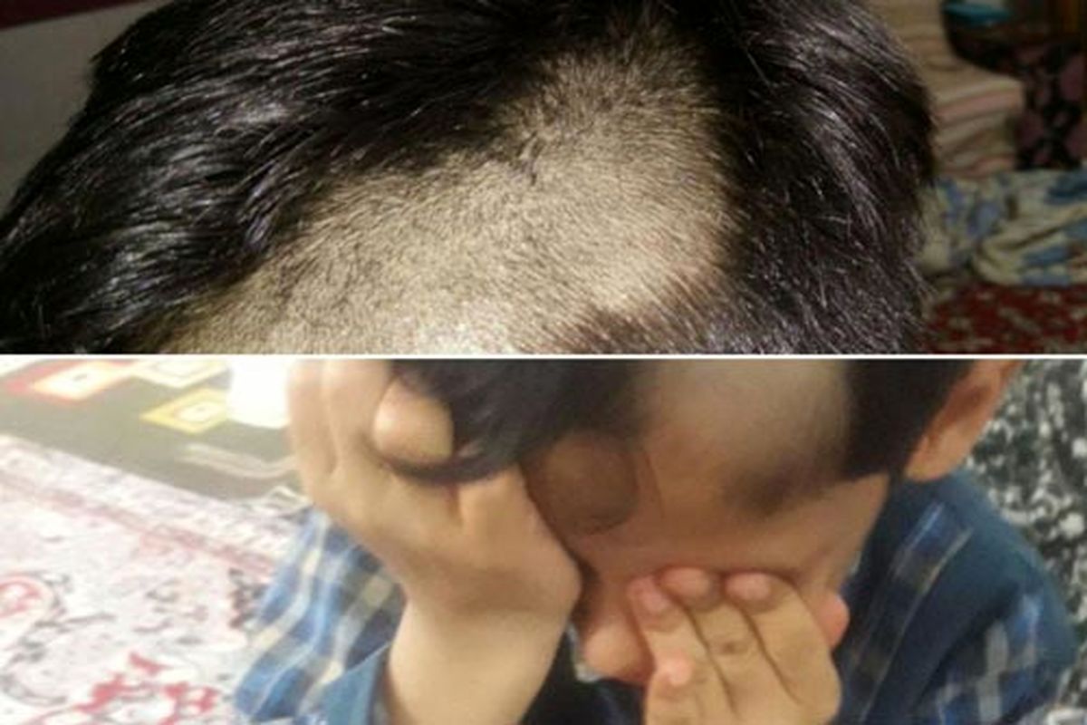 کچل کردن دانش آموزان