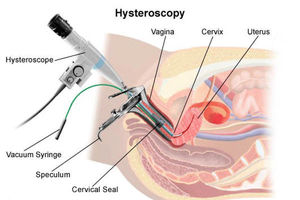 عکس رنگی رحم چیست؟/ به چه دلیل عکس رنگی از رحم  تجویز می شود؟