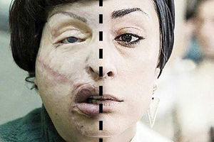 «لانتوری» اسیدپاشی شد اما فروخت / رقابت نابرابر درمیشیان و فرهادی!